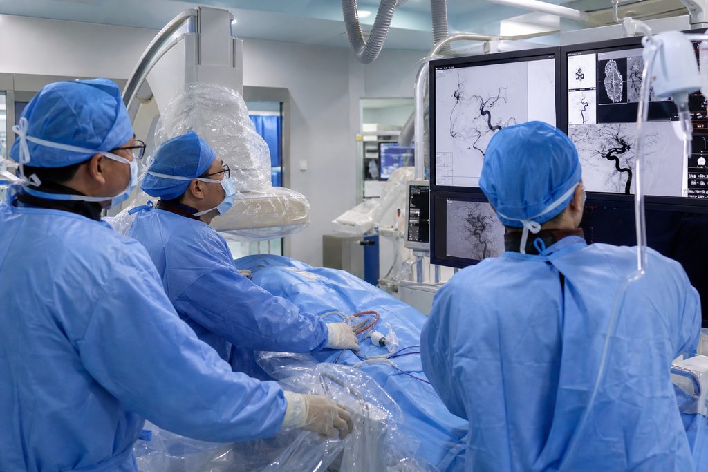 AVM interventional neuroradiology China - medical illustration