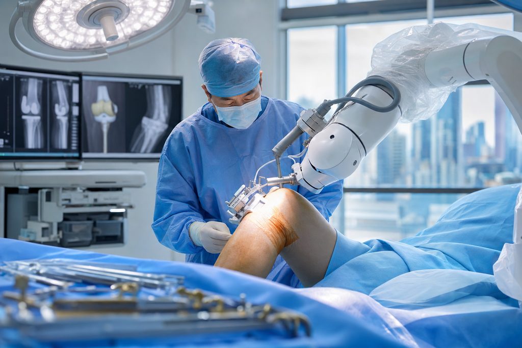robotic knee replacement cost China - medical illustration