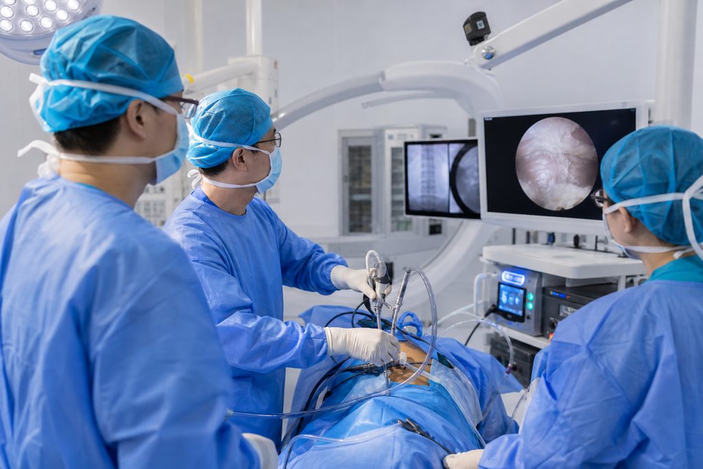 endoscopic spine fusion cost China - medical illustration