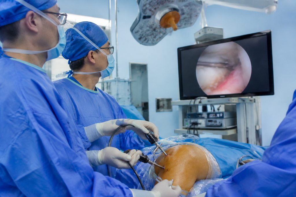 ACL surgery cost Shanghai Sixth People H - medical illustration