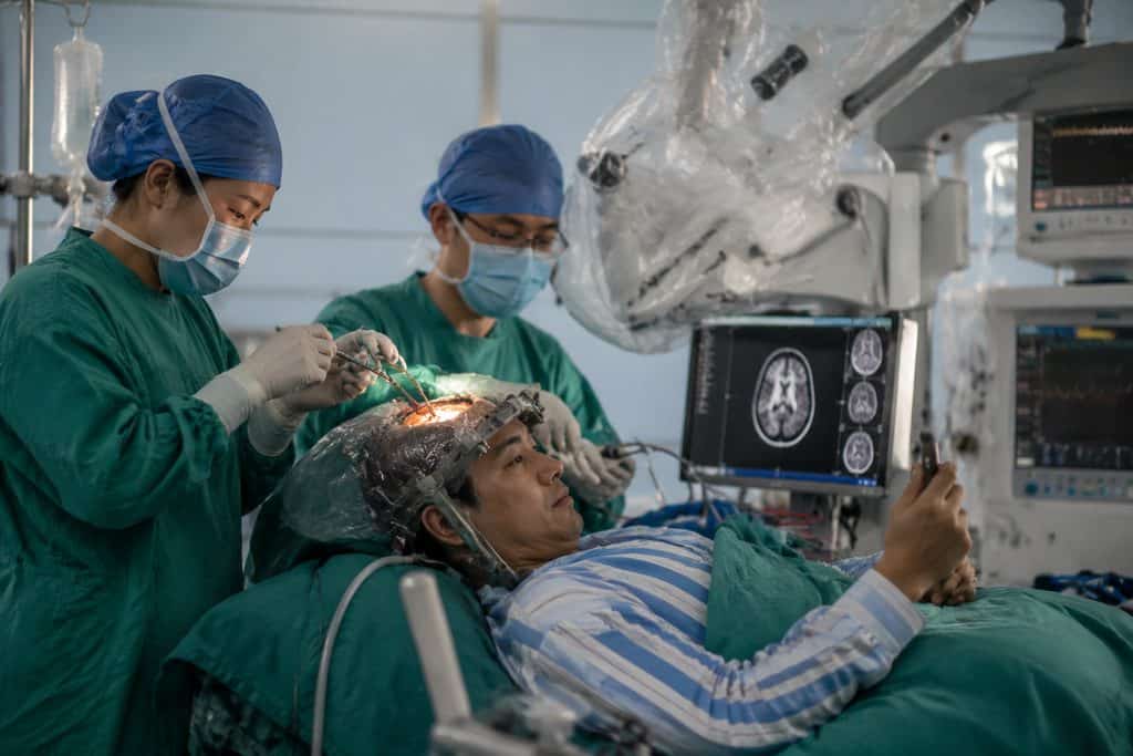Awake Craniotomy Risks: What Brain Surgery Patients Must Know in 2025 — awake craniotomy cost China