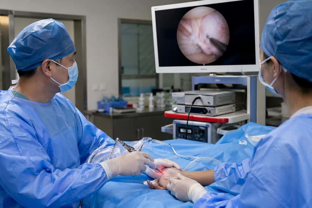 Carpal Tunnel Surgery Cost China: Open vs Endoscopic Release Pricing Guide