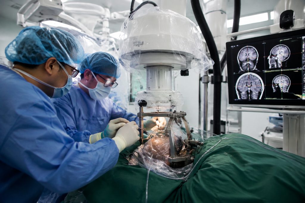 deep brain stimulation cost Shanghai Hua - medical illustration