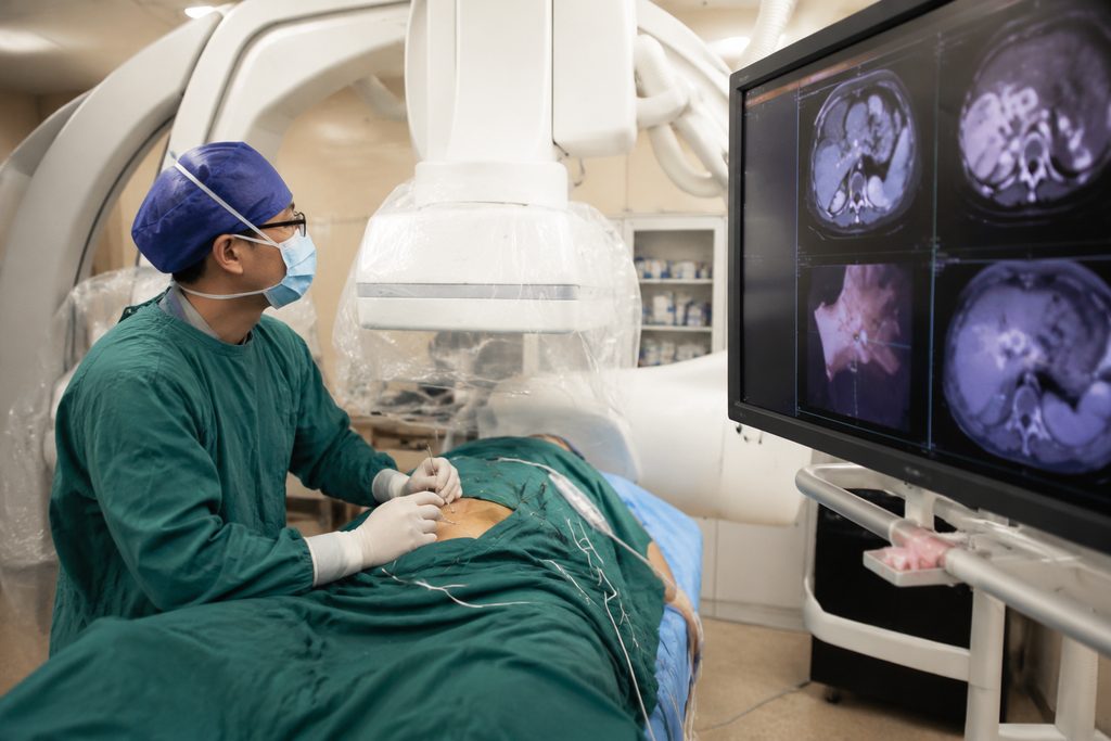 Liver Cancer Surgery in China: Costs, Hospitals, and Real Timelines — liver cancer surgery cost China