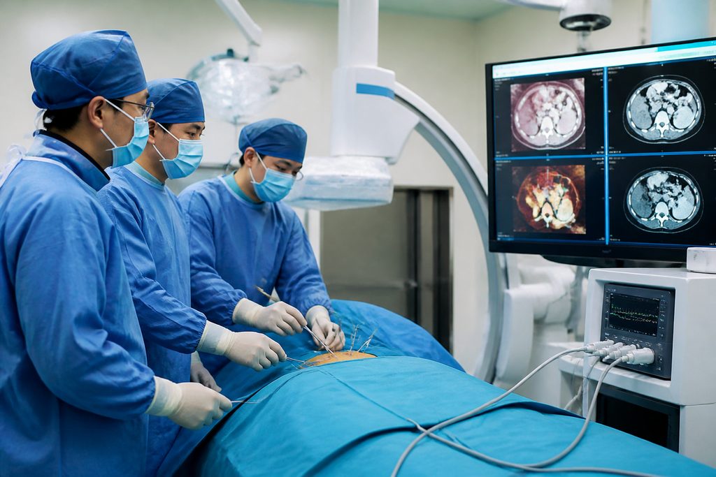 NanoKnife IRE cost China - medical illustration