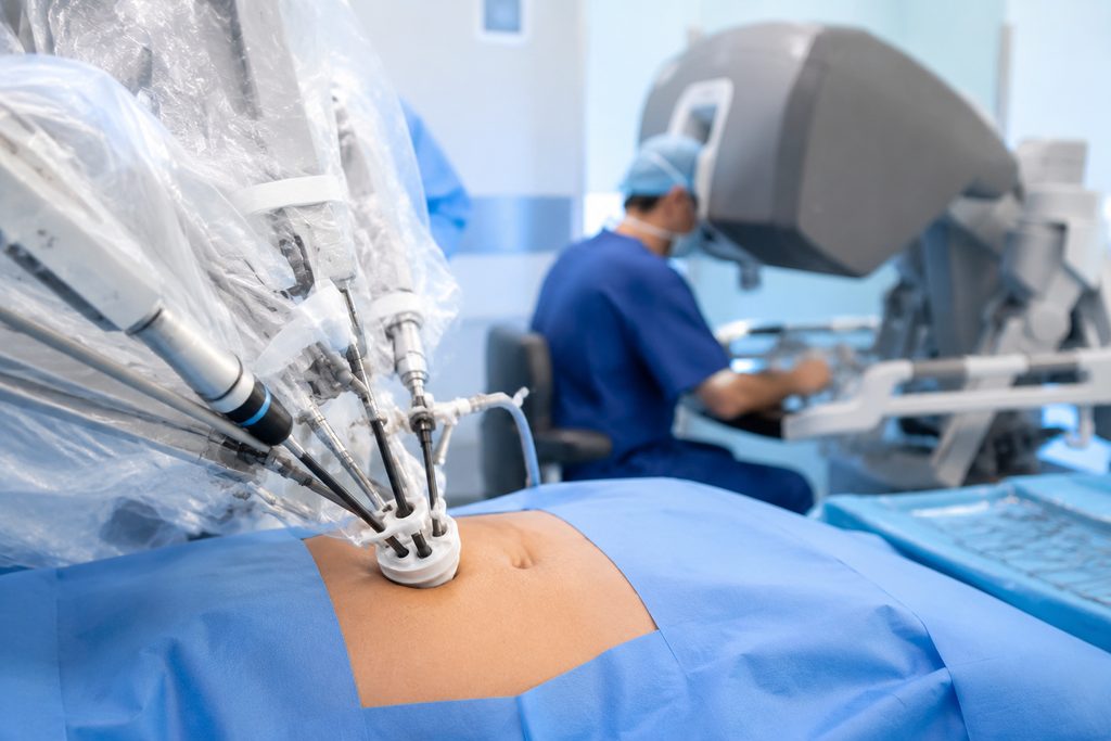 Scarless Surgery in China: Single-Port Laparoscopic Costs & Access — single port laparoscopic surgery cost China